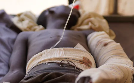 Paramilitary Accepts Sudan Truce Plan, but the Military Has Not