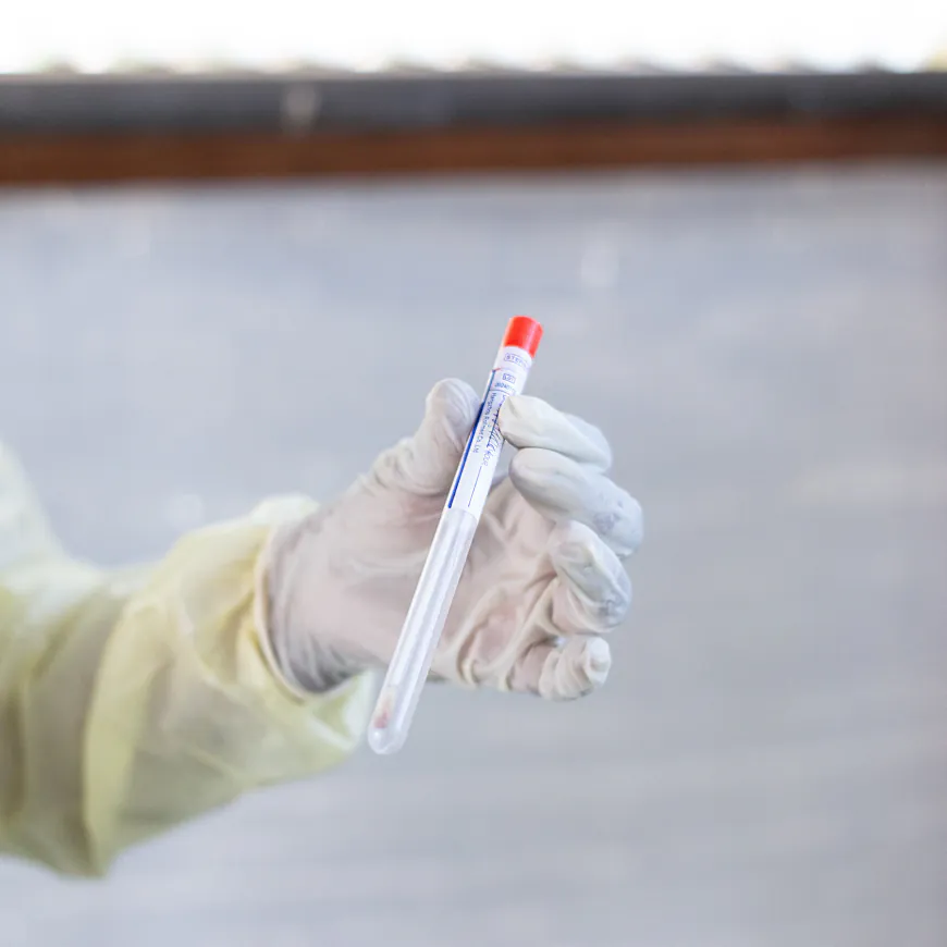 Scientist Charged With Conspiring to Smuggle Mpox Virus Into U.S.