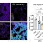 Modified cell vesicles trigger 'lipid counterstorm' against lung inflammation in mice