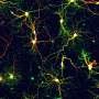 Atomic view of Alzheimer's disease peptide could inform new drugs