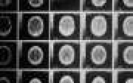 Light-activated nanoparticles could help surgeons find and destroy brain cancer remnants